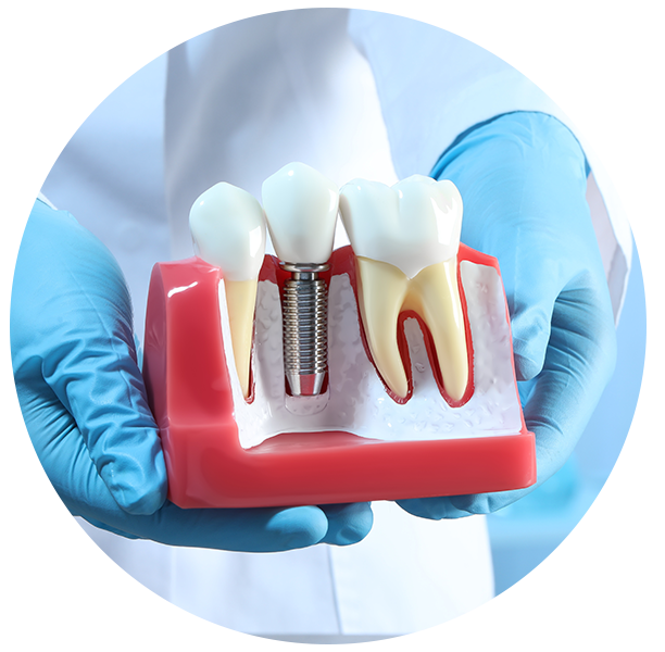 dental bridge specialists