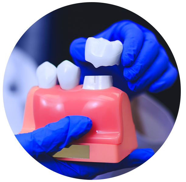 teeth whitening in Aldershot